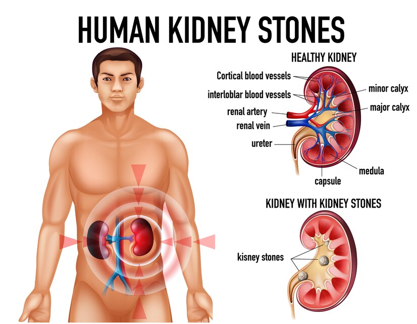 kidney